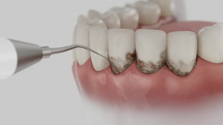 Trusted Tooth Extraction service in Marion, VA - Dentist Open Now